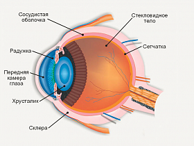 Люксация хрусталика - хрусталик, иол, катаракта, дистопия, люксация, сублюксация