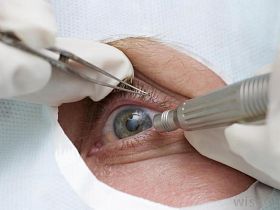 Парабульбарное введение препарата